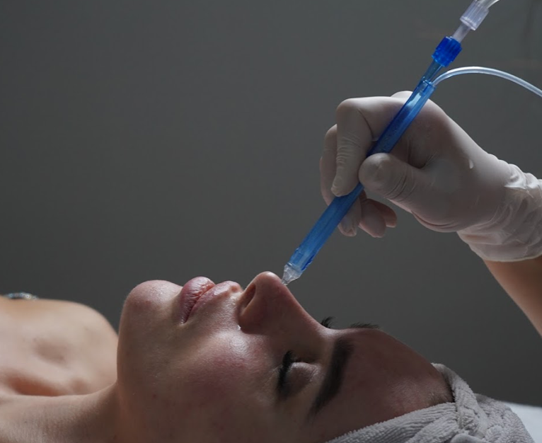 JetPeel-Behandlung im Gesicht einer Kundin – Feuchtigkeit und Glow als Anti Aging bei AFACIAL Wien