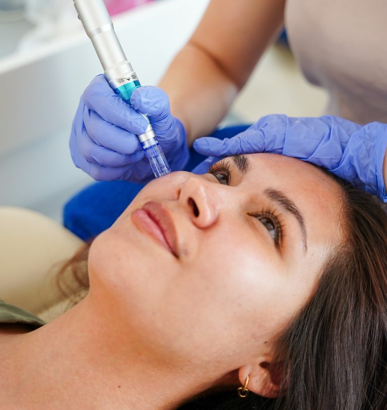 Kosmetikerin behandelt die Wange einer Kundin mit einem Microneedling-Pen bei AFACIAL in Wien