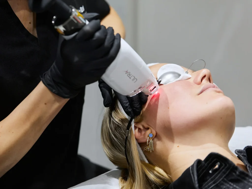 Laserhandstück am Gesicht, Kundin mit Augenschutz - Pigmentflecken entfernen mit Laser in Wien