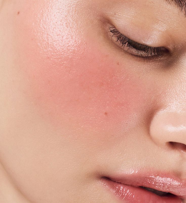 Nahaufnahme einer Wange mit frischem Glow nach der Laser Gesichtsbehandlung in Wien