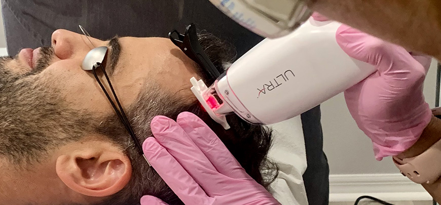 ULTRA-Laserhandstück am Gesicht, Kunde mit Laserschutzbrille – Laser Gesichtsbehandlung in Wien